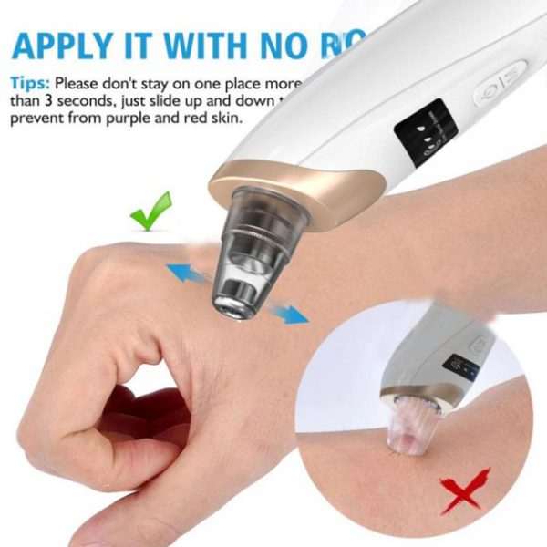 Premium Electric Blackhead Suction Remover - Portable Pore Cleaner